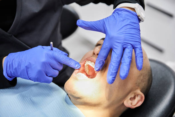 Best Emergency Treatment for Dental Infections or Abscesses in East Sonora, CA